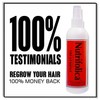 Greatest Hair Loss Results by Nutrifolica - Grows Frontal Crown
