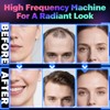 High Frequency Stick Face, ROMMQB Argon and Neon Skin Therapy