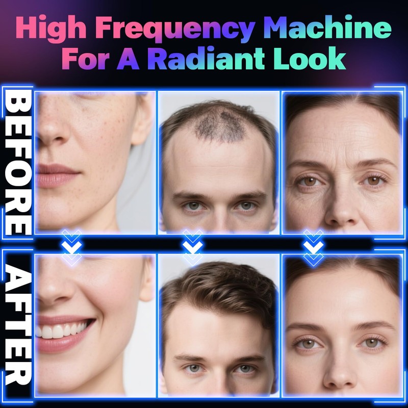 High Frequency Stick Face, ROMMQB Argon and Neon Skin Therapy