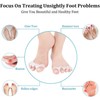Soft Gel Toe Spacers, 2 Pairs, for Bunions & Plantar