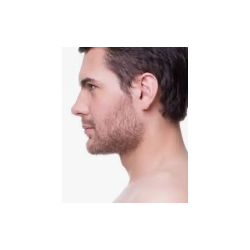 Crema\gel Tratamiento P Cuello Caido Gordo Papada Flacides