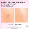 L'ORÉAL PARIS SKIN Kit anti-manchas Glycolic Bright: Sérum 30ml +