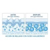Tratamiento Anti Edad Jaysuing Con Ácido Hialurónico 30ml