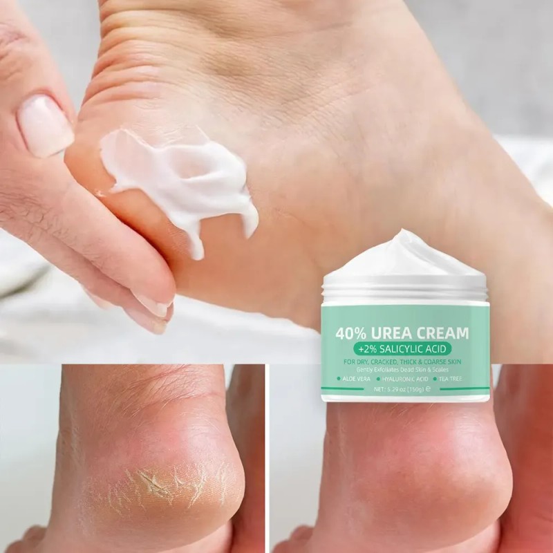 Crema De Urea 40% + 2% Ácido Salicílico Para Pies