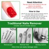 3pcs Gel Nail Polish Remover Set - Quick & Easy