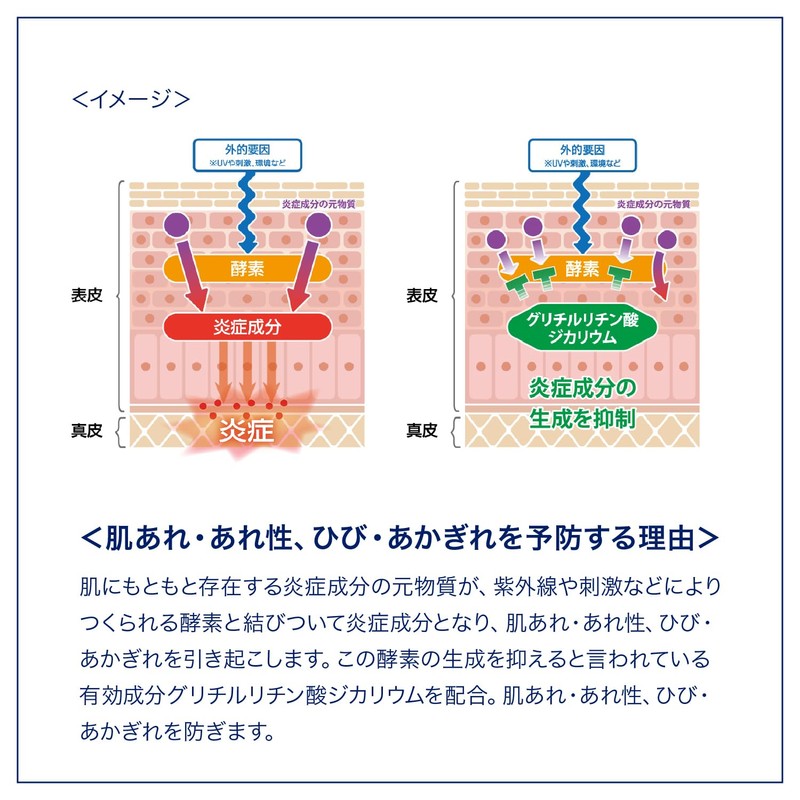 Vaseline (ヴァセリン) Medicated Sensitive Care Body Lotion Moisture Care 350