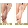 ProLinc Be Natural Callus Eliminator Original 128 fl oz, 1