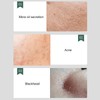 2pcs Face Sponge, Strong Cleansing Power, Porous Adsorption, Effective Cleaning
