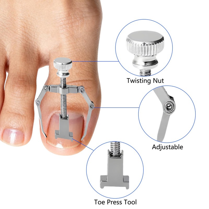 CHEMAILON Professional Ingrown Toenail Correction Kit - Stainless Steel Ingrown
