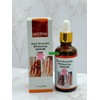 Mooyah Strong Whitening Dark Skin Knuckles Feets Knees Elbows Armpit