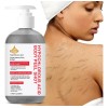 Gel Corporal Exfoliante Ácido Hipocloroso 200ml No
