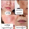 HC DELEAF BRIGHTENING FACIAL SOAP သလဲသီးဆပ်ပြာ ❤️