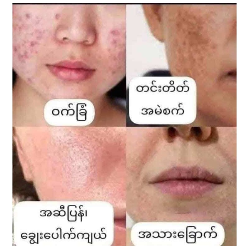 HC DELEAF BRIGHTENING FACIAL SOAP သလဲသီးဆပ်ပြာ ❤️