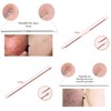ZTRHYOO Blackhead Remover Pimple Comedone Extractor Tool Best Acne Removal