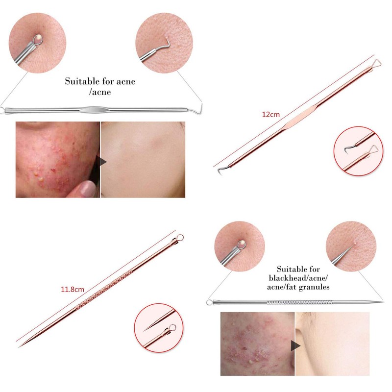 ZTRHYOO Blackhead Remover Pimple Comedone Extractor Tool Best Acne Removal