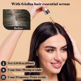 Giofna Hair Turmeric Oil, Hair Growth Serum for Curly, Thick, Frizzy, Dry, and Damaged Hair for Scalp Nourshing, Hair Strengthening, Scalp Care Products for Women and Men