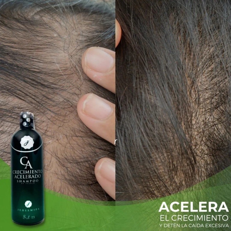 Shampoo Crecimiento Acelerado ( 3 Shampoo )