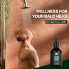 BETTER BE BOLD Champú Para Calvas (0-3 Mm), Limpia Eficazmente