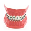 Dentalmall Typodonts Orthodontics Demonstration Model with Metal Wires and Bracket