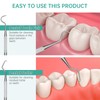 Professional Dental Scraper Tool - Dentist Pick, Medical Stainless Steel,