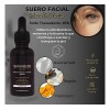 Ácido Tranexámico 10% Manchas Rebeldes Paño Melasma 2pack Todo Tipo