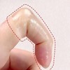 Tape protector to prevent nail biting Improve finger hygiene Dental