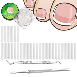 (30+2) Pack Ingrown Toenail Correction Treatment Kit, 30PCS Ingrown Toenails Corrector Strips Brace Ingrown Toenail Pedicure Tool Toenail Correction Patch with 2PCS Ingrown Toenails Lifter and File