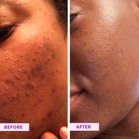 Sand & Sky Australian Glow Berries Enzyme Powder Exfoliant 60g