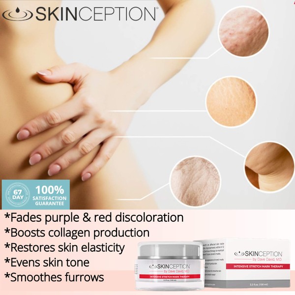 Skinception 3 Month - Intensive Stretch Mark Therapy Cream Stretch Mark Remover Removal