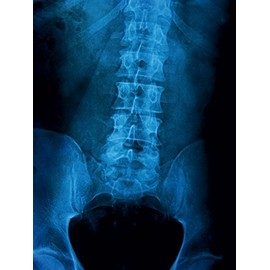 CALVENDO Puzzle X-ray image of a lumbar spine. 1000 pieces, size 48 x 64 cm, photo puzzle picture of Georg Hanf