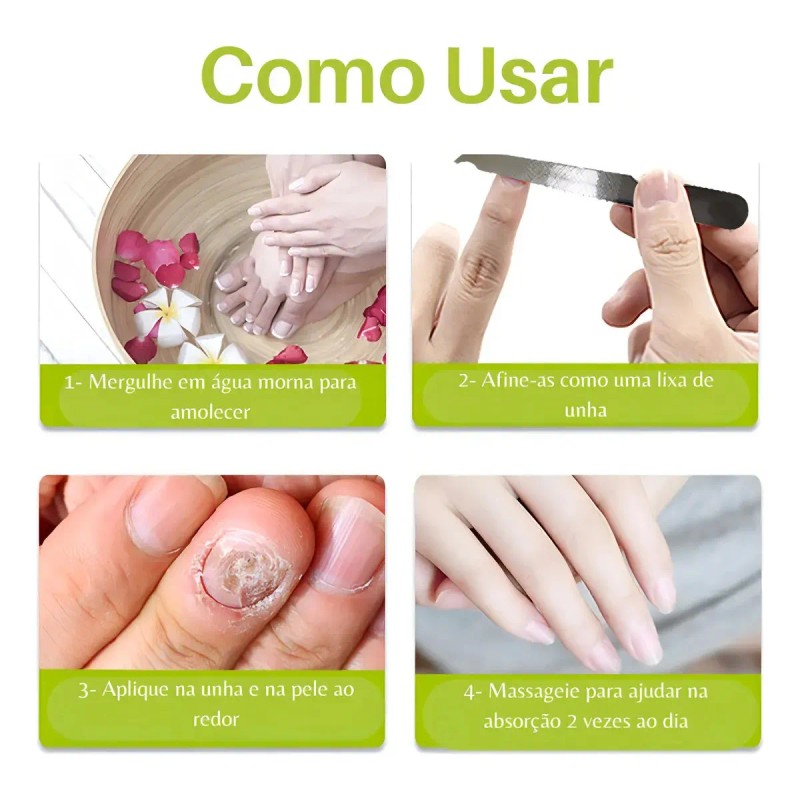 1pzs Crema Natural Hongos Uñas Pies Efero Gel Reparador 20ml