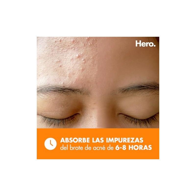 Hero Parches para Acné Mighty Patch Surface, Caja con 10