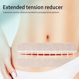 Sutures Adhesive Bandages 7.9 in 1 PCS Surgical Laceration Repair Without Sew Quick Clot Emergency Wound Closures Device