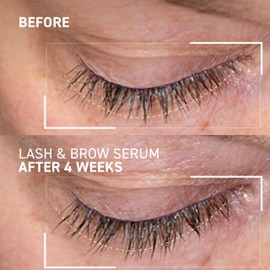 Dr. Brandt Dr. B Lab Lash & Brow Serum - Growth & Conditioning Formula for Longer, Fuller Hair Follicles - 0.17 fl oz