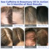 Serum Para El Crecimiento Del Cabello Eoiroa Con 3% De