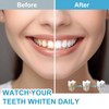 Teeth Whitening Kit with LED Light, 10 Min Non-Sensitive Fast