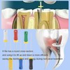 Smileheven Endodontic Root Canal Hand H Files Stainless Steel Hand