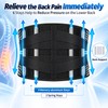 Umbilical Hernia Belt for Abdominal Support – Lumbar Support Belt