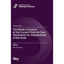 The Mode of Actions of the Current Point-of-Care Treatments for Osteoarthritis of the Knee