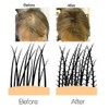VolumON Professional Hair Building Fibres Hair Loss Concealer Cotton 12g – Black
