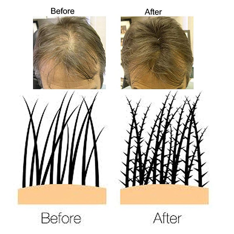 VolumON Professional Hair Building Fibres Hair Loss Concealer Cotton 12g – Black
