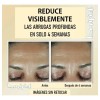 Roc Retinol Correxion Deep Wrinkle Suero + Relleno 30+30ml