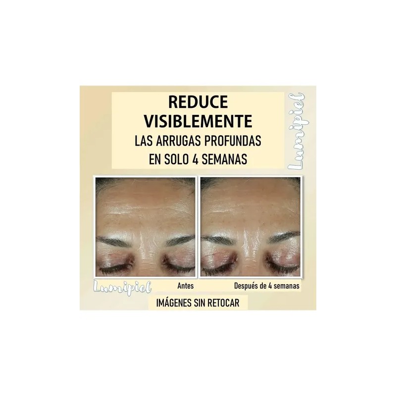Roc Retinol Correxion Deep Wrinkle Suero + Relleno 30+30ml