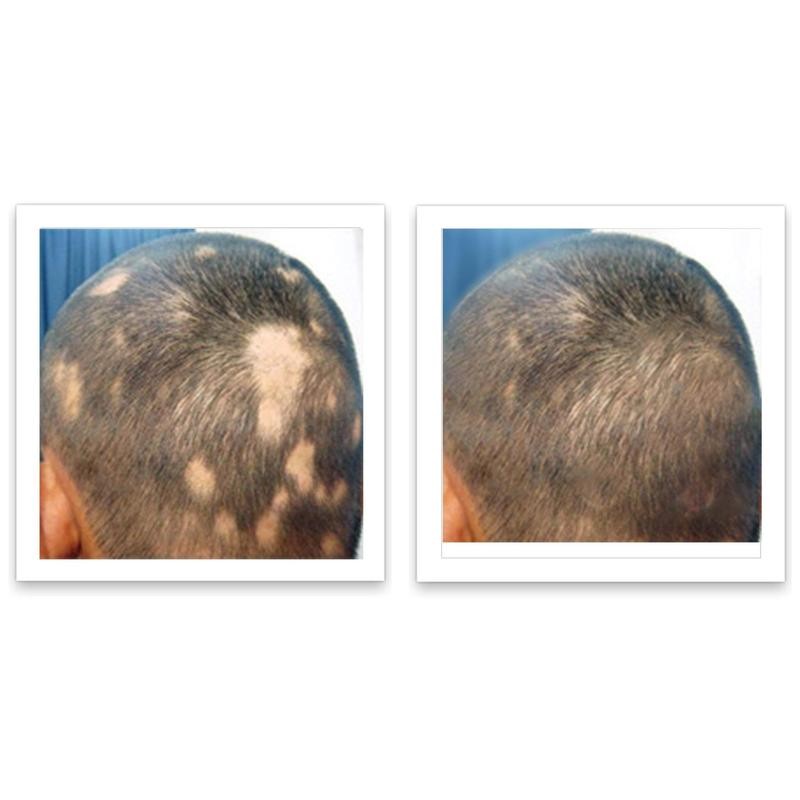 Caboki 10X Hair Powder - Trial Size:_Light Auburn