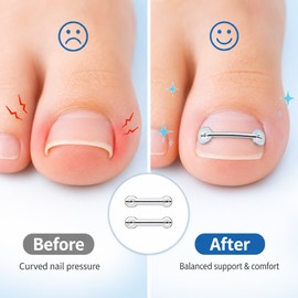 Toenail Care Brace Stickers for Daily Wear – 2PCS Flexible Pedicure Support Tool for Men