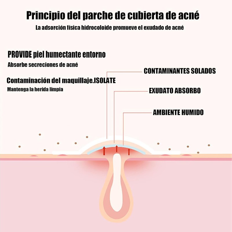 LUHI 200PCS Parches para Acne,Pimple Patch, Parches para Espinillas, Almohadillas