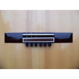 Rosette Diamond BridgeBeads Diamond BridgeBeads for Classical Guitar, Nylon String Guitar String Ties - Black