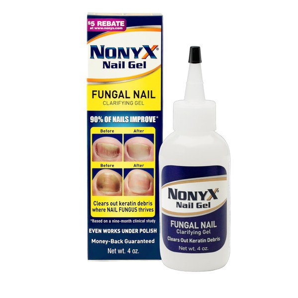 NONYX Nail Gel Rids Nails of Fungus by Removing its Food Supply - Keratin Debris | 90% of Nails Improve Using this Nail Fungus Treatment | 4 fl. oz.