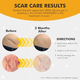 DermAvance Pure Scar Care Gel De Silicona Médicamente Graduado Para Cicatrices, Cicatrices Quirúrgicas Y Rostro - Crema De Silicona Para Cicatrices, G