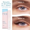 FEG Suero de Crecimiento de Pestañas y Cejas Eyelash and